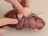 How to trim a Kidney - 3